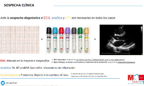 Miocarditis y miocardiopatías inflamatorias